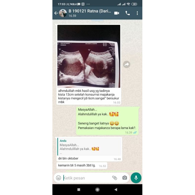 Manjakani Kanza 100% Asli / Obat Keputihan Gatal Bau Paling Ampuh BPOM / Pelancar Haid / Obat Kista Miom Ovarium Bartholin Tanpa Operasi / Obat Endometriodis PCOS Ampuh Teruji Klinis / Program Hamil Herbal Promil-6