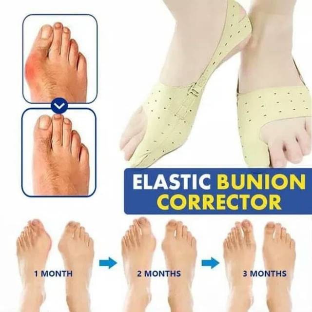 Bunion Elastic Corrector Pelurus jempol kaki nyaman bersepatu