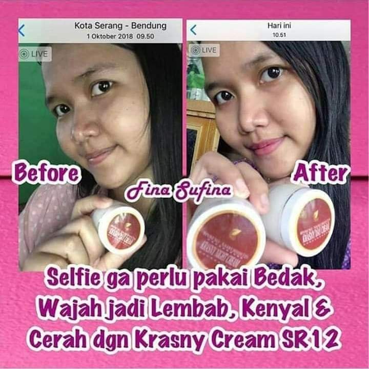 Krasny Cream SR12 | Krasny Day Cream SR12 &amp; Krasny Night Cream SR12 | Krim Wajah SR12 Skincare