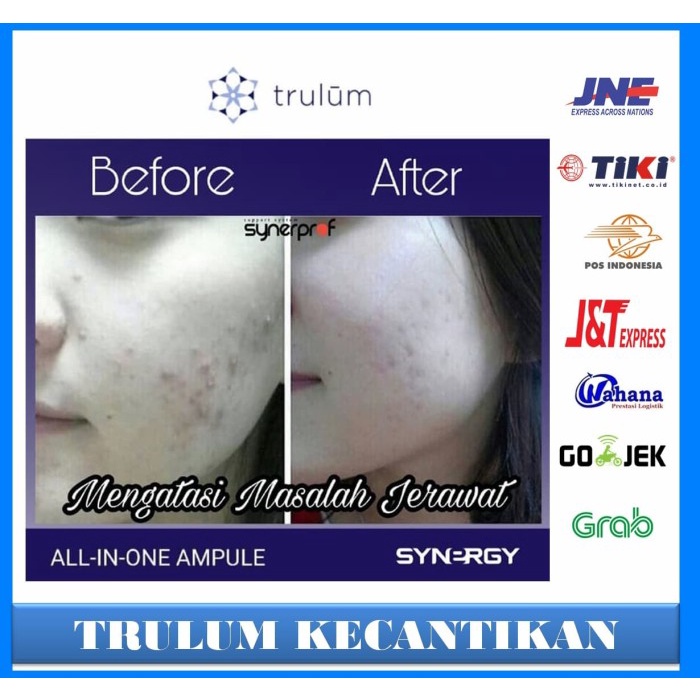 q201q1a Krim / Cream Pemutih Wajah Praktis - Trulum Spray Skincare Untuk Semua Zc2Z01X