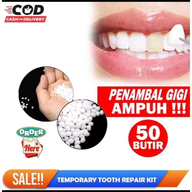 GIGI PALSU SEMENTARA PENAMBAL GIGI PATAH RENGGANG TEMPORARY TOOTH TEMPTOOTH GINGSUL PATAH KELINCI