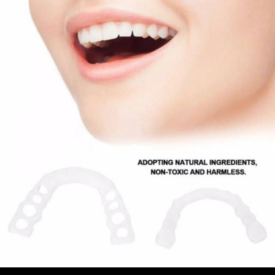 Snap On Smile Veneer Instan Gigi Palsu Tiruan Kesehatan Mulut Mouth Ok