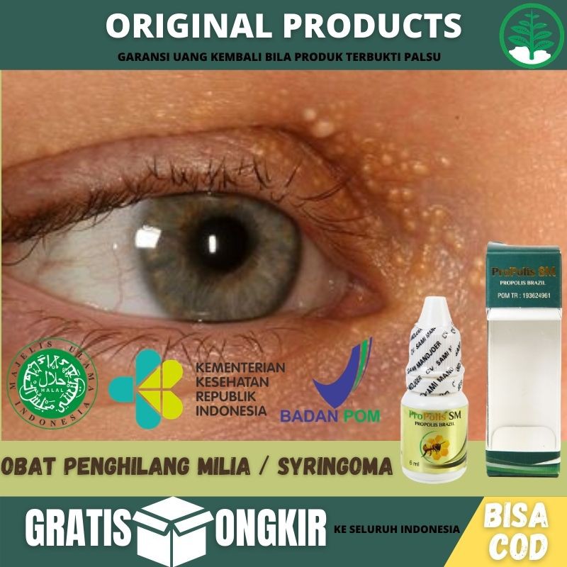 Obat Oles Menghilangkan Milia / Syringoma - Obat Pembasmi Bruntusan Di Mata Obat Milia Di Bawah Mata