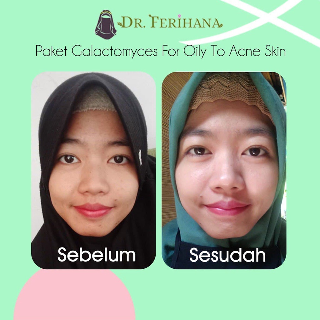 Paket Premium Galactomyces Whitening for Oily &amp; Acne Skin dr. Ferihana Cosmetics &amp; Skincare Paket Perawatan Wajah untuk Kulit Berminyak Berjerawat Ringan Sedang sampai Meradang Bernanah Sekaligus Mencerahkan Memudarkan Bekas Anti Aging BPOM LPPOM HALAL