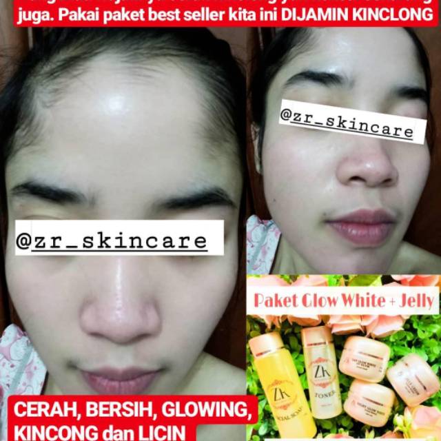 Paket Glow White ZR skincare  ISI 7 glowing