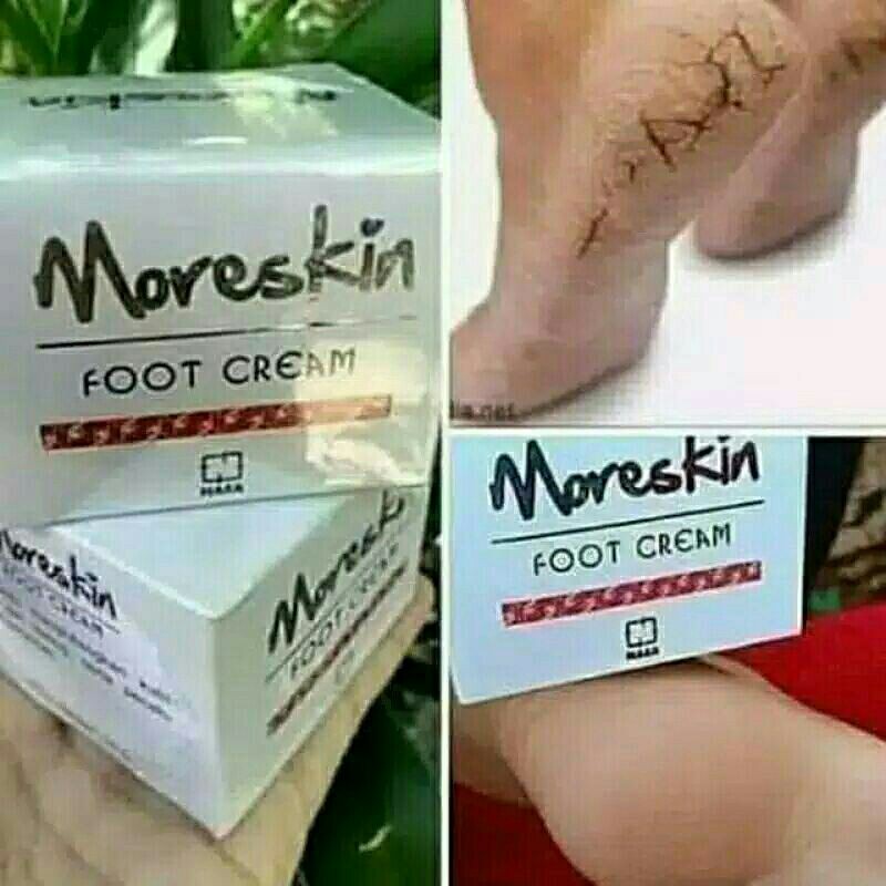 Obat kaki rayapan - Obat kaki pecah dan kering - Obat kaki pecah2 -Obat kaki pecaah dan kering ampuh