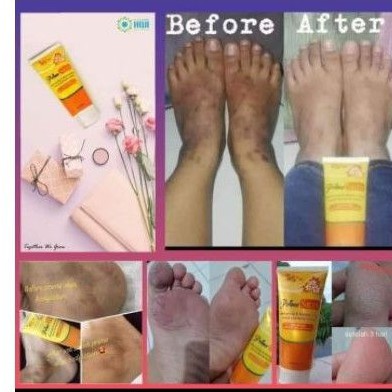 Prime Skin Lotion Ori mencerahkan , penghilang bekas luka /koreng