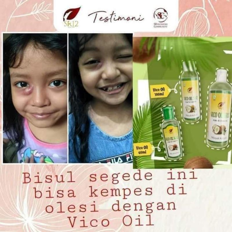 

VCO Virgin Coconut Oil(minyak sejuta manfaat)