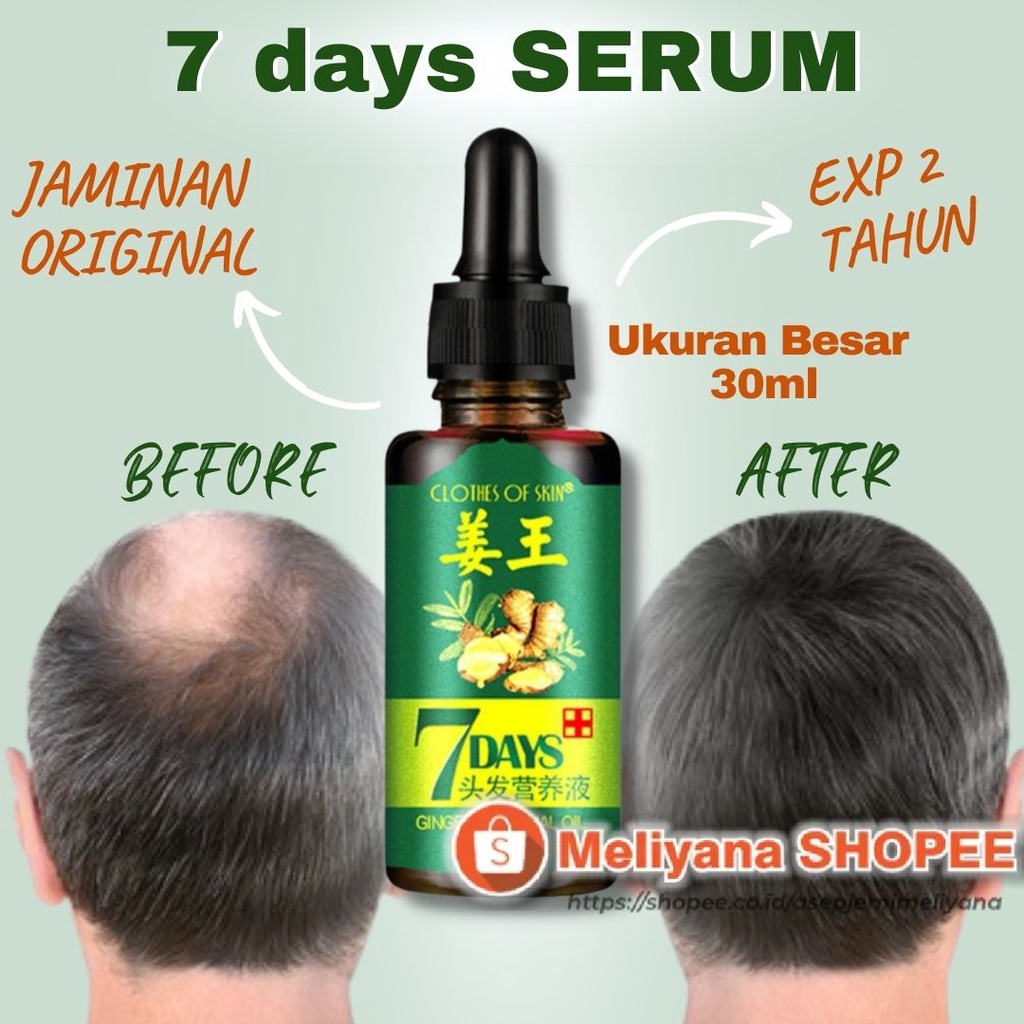 7 Days Clothes Of Skin Minyak Penumbuh Rambut Ginger Germinal Oil