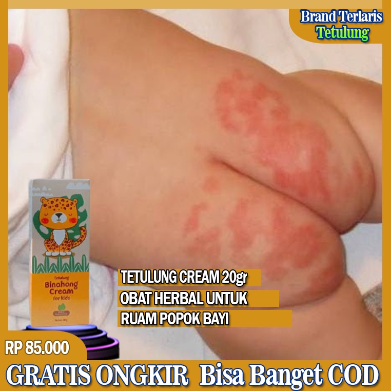 Salep Binahong Cream Untuk Anak Ampuh - Obat Gatal Ruam Popok Pada Bayi/anak