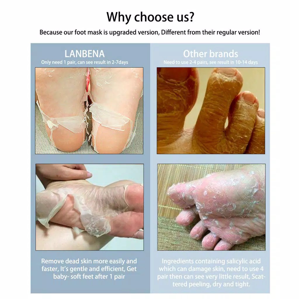 LANBENA Foot Mask Exfoliating Foot Care Remove Dead Skin Pedicure