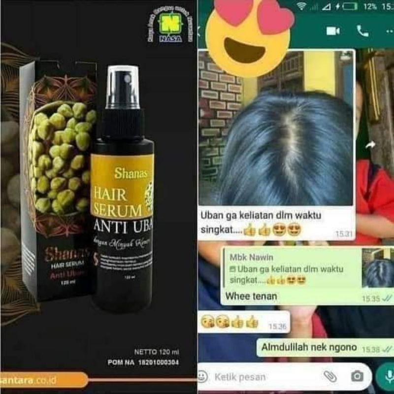shanas shampo anti uban dan kutu