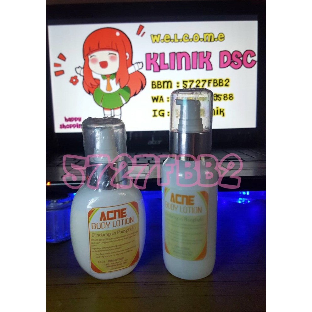 DSC ACNE BODY LOTION