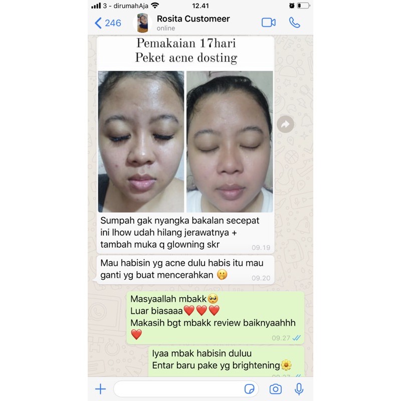 Paket Acne Dosting Colista skin Care-2