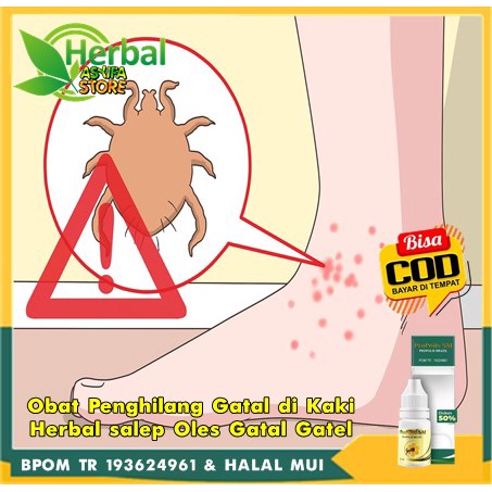 Obat Penghilang Gatal di Kaki Herbal salep Oles Gatal Gatel skabies di Kaki - Psoriasis di Kaki - Ne