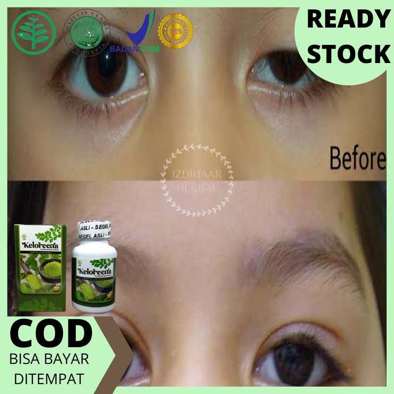 Jual Obat Mata Floaters Obat Herbal Mata Ptosis Obat Alami Mata