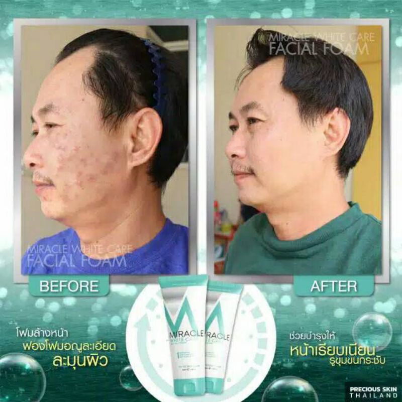 MIRACLE WHITE CARE SOFT &amp; SMOOTH FACIAL FOAM / SABUN MUKA / SABUN WAJAH / PEMBERSIH MUKA