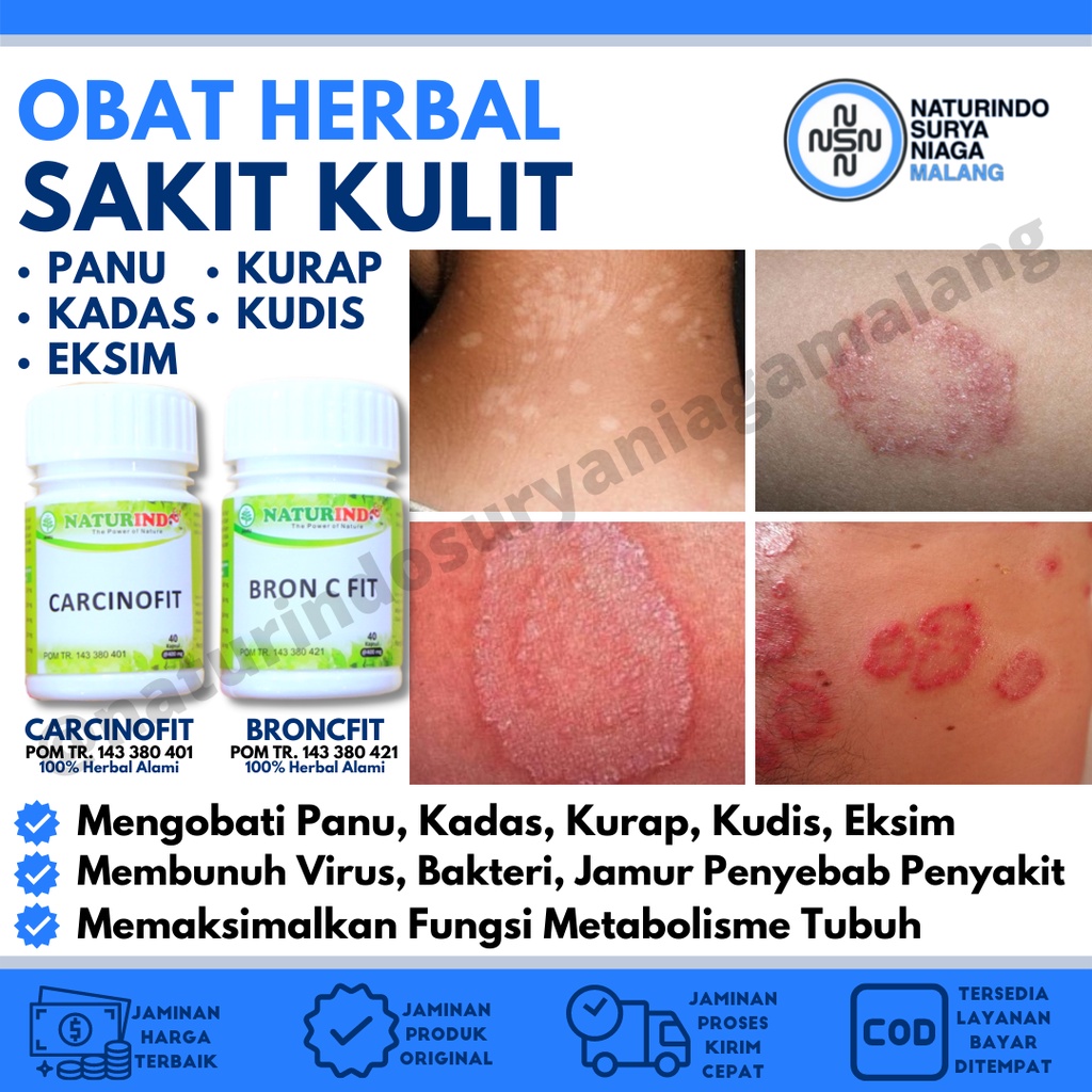 Obat Panu Obat Gatal Paling Ampuh Obat Gatal Kulit Obat Kurap Paling Ampuh Obat Gatal Kulit Paling A