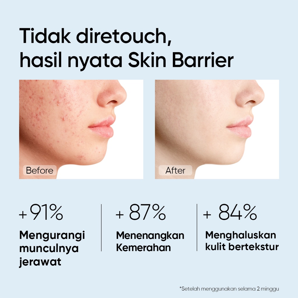 [FLASH SALE] - SKINTIFIC 5X Ceramide Skin Barrier Repair Moisturize Gel 30g Moisturizer Cream Pemutih Wajah Day Cream Night