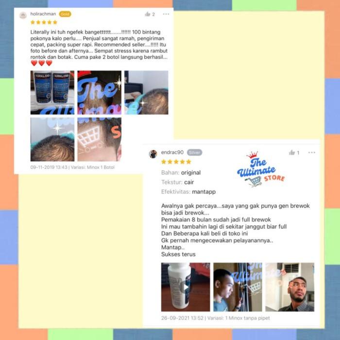 Kirkland Signature Minoxidil 5% Topical