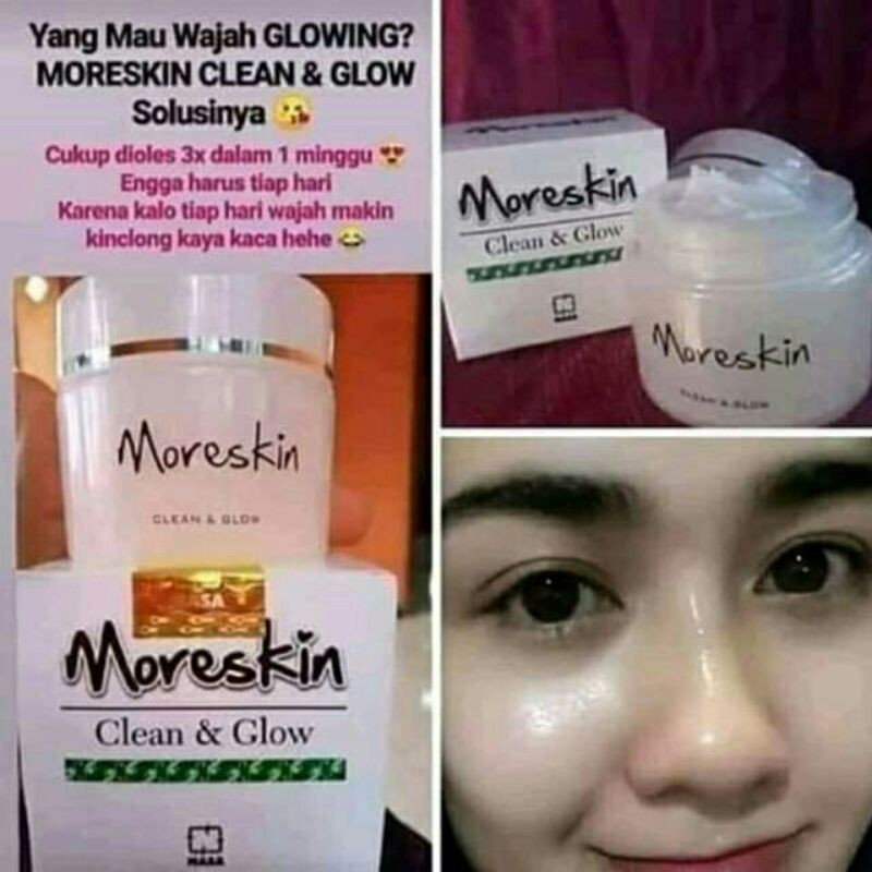 

moreskinnasa