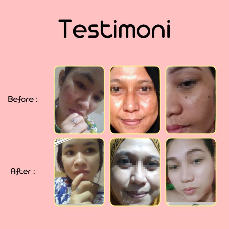 [ Free Gift &amp; Open Reseller ] Reglow SkinTreathment by Dokter Shindy Putri cream hempas jerawat dan buat glowing