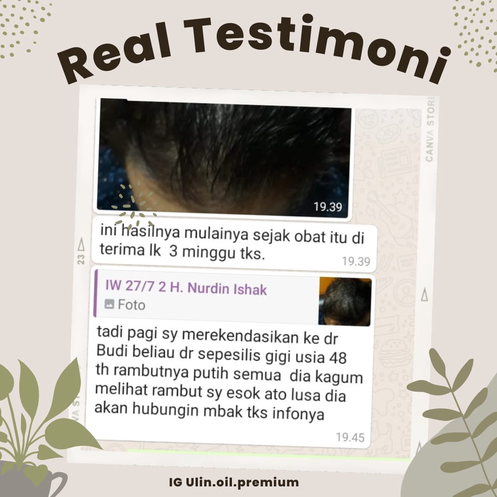 ulin oil premium obat serum anti uban penghitam rambut 3 botol