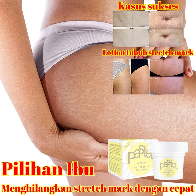 O'RANNLE Original StretchMark Cream Krim、Stretchmark Krim penghilang stretch mark (aman halal alami dirancang khusus untuk ibu hamil) Lotion stretch mark