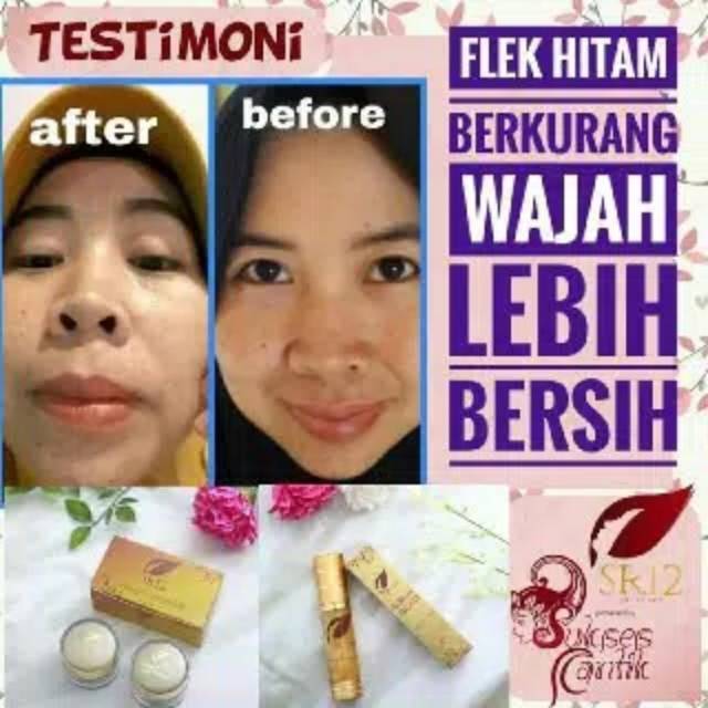 TUMPAS BEKAS JERAWAT , FLEK HITAM &amp; NODA WAJAH / ANTI AGING / SPOT ESSENCE DAY &amp; NIGHT CREAM SR12 STANDAR BPOM