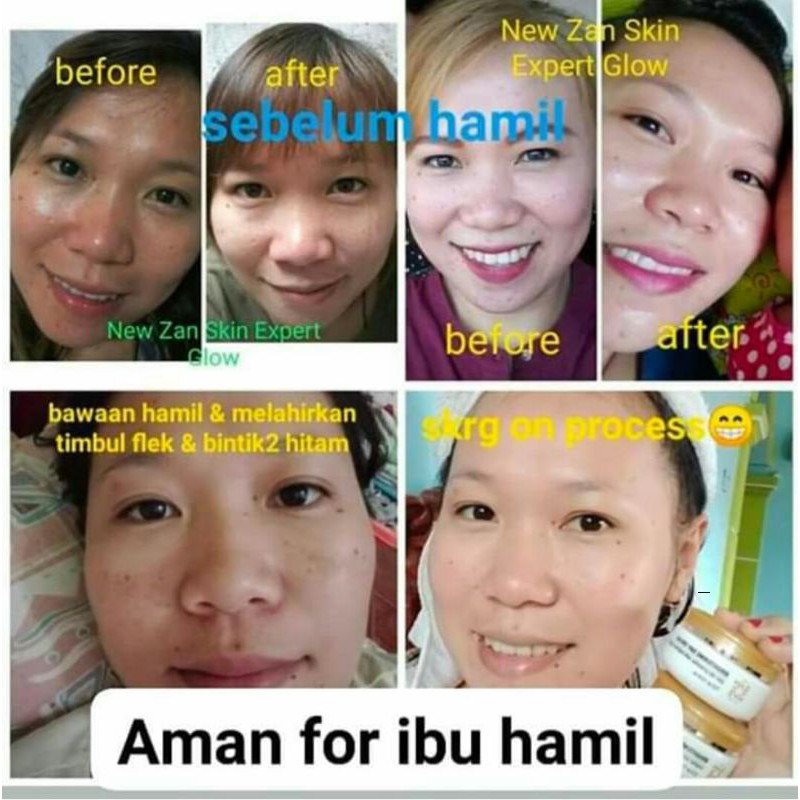 paket new zan normal glow