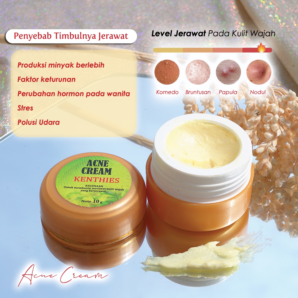Acne Cream Krim Totol Kenthies Kosmetik Kulit Wajah Muka Berminyak Berjerawat Pasir Batu Nanah Bpom