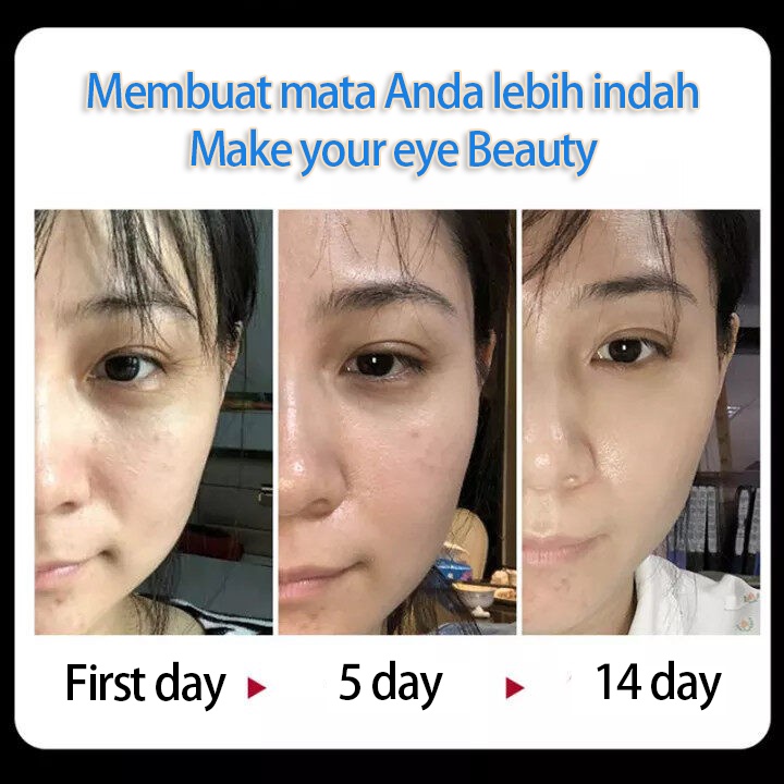 Eye cream Krim mata Dark circle eye cream Krim mata lingkaran hitam Krim mata anti penuaan 30g perawatan mata Menyehatkan area mata Meringankan lingkaran hitam Meringankan kantung mata dan butiran lemak