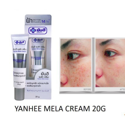 (READY JAKARTA) YANHEE YAN HEE MELASMA &amp; DARK SPOT (PENGHILANG FRECKLES CREAM)