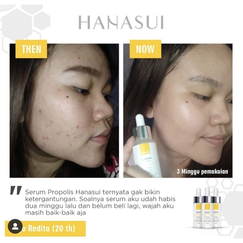 BPOM serum wajah implora ORIGINAL WHITENING ACNE GLOW