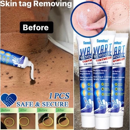 𝗦𝘂𝗺𝗶𝗳𝘂𝗻 𝗪𝗮𝗿𝘁 𝗥𝗲𝗺𝗼𝘃𝗮𝗹 𝗦𝗸𝗶𝗻 𝗧𝗮𝗴 Eelhoe Wart Remover 100% Original