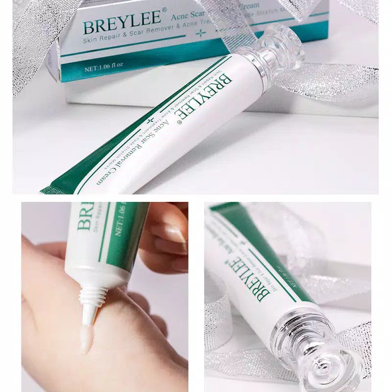 BREYLEE Acne Scar Removal Cream Keloid Acne Mark