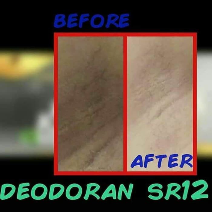 DEODORANT SR12 DEODORAN PENGHILANG BAU BADAN HERBAL BPOM