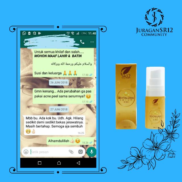 SR12 SERUM REVITALIZING ATASI BOPENG , BEKAS JERAWAT &amp; MATA PANDA / SERUM WAJAH KOLAGEN BPOM