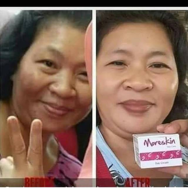 MORESKIN PINK / MORESKIN / DAY CREAM MORESKIN PINK / NIGHT CREAM MORESKIN PINK