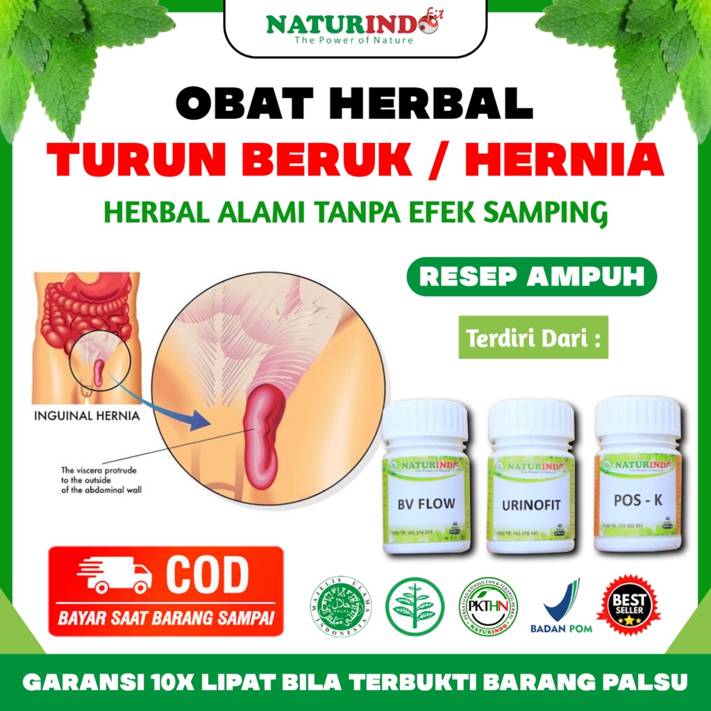 Obat Hernia Paling Ampuh Obat Hernia Obat Turun Berok Dewasa Dan Anak Obat Herbal Hernia Anak Dewasa