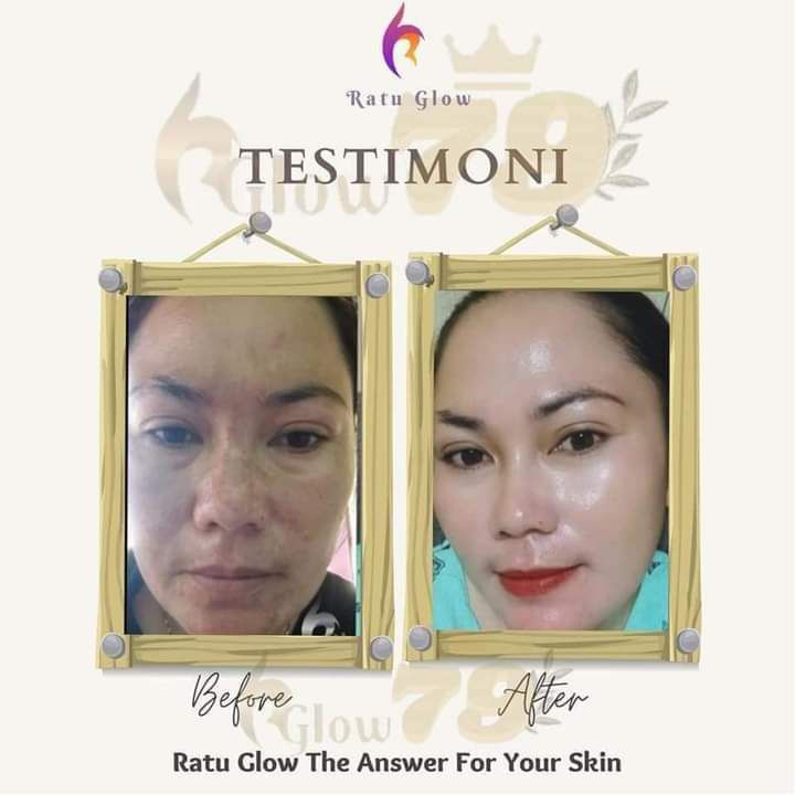 Ratu Glow Skincare BPOM Viral PAKET CREAM WAJAH Glowing series Paket Normal Flek Jerawat bopeng |skincare pelicin wajah-6