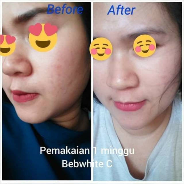 testimoni bebwhite c skincare