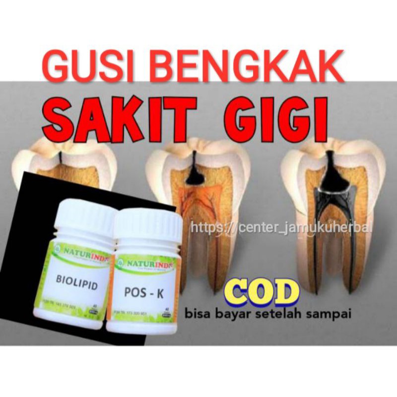 COD PAKET OBAT HERBAL GIGI SAKIT GUSI BENGKAK DAN BERDARAH.NATURINDO FRESH