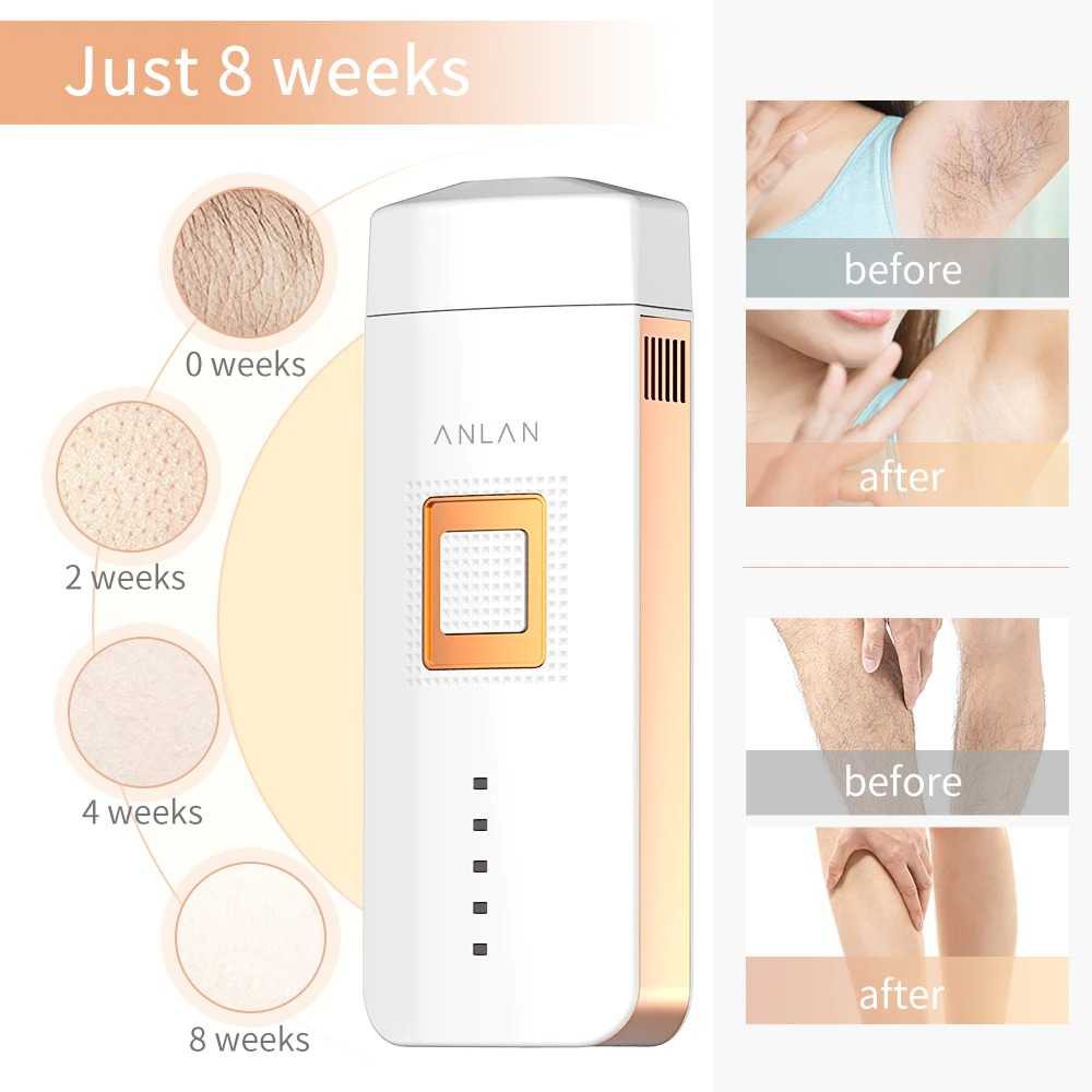 Penghilang Bulu Laser Epilator Hair Removal 500000Flashes ANLAN TMY02 IPL ALTMY02-EU02 - G1HX01WH