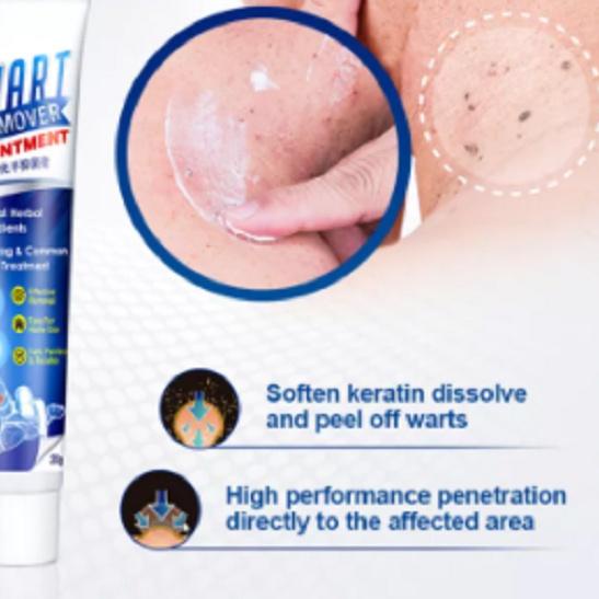 ☆ Wart Remover Ointment Skin Tag Remover ✫