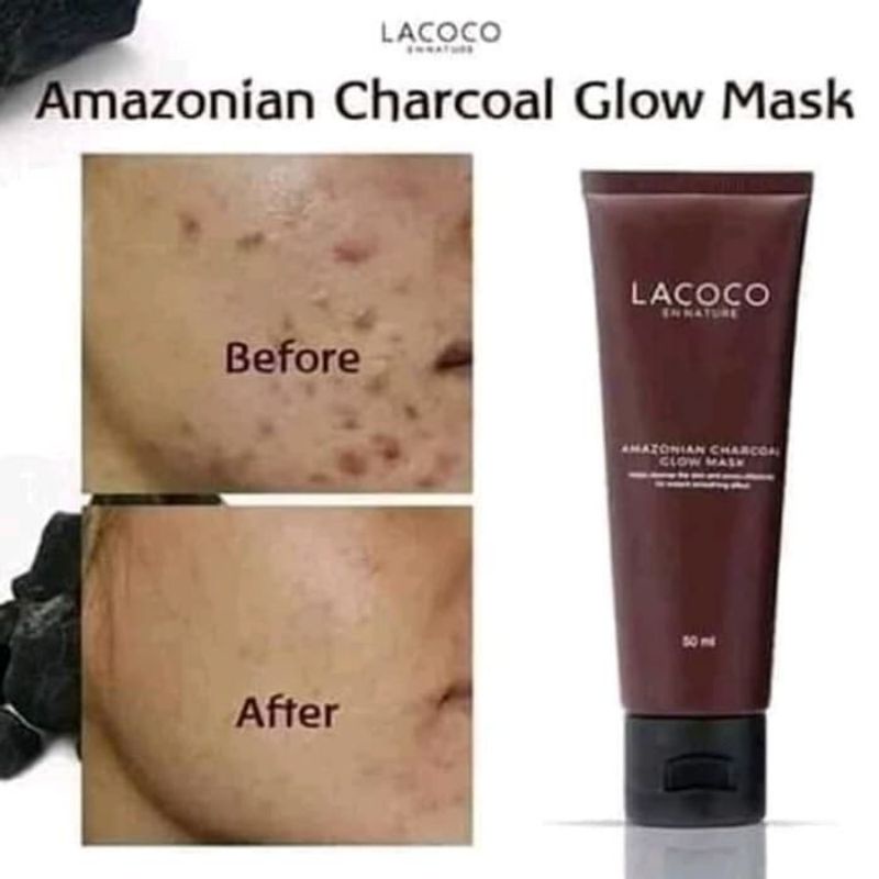 CHARCOAL MASKER/MASKER KOMEDO//MASKER KULIT BERMINYAK