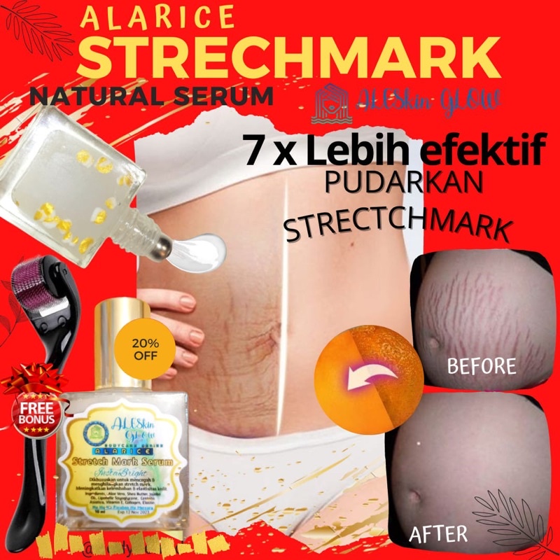 ALARICE STRECHMARK CREAM PENGHILANG STRETCH MARK PALING AMPUH PERMANEN UNTUK IBU HAMIL 1