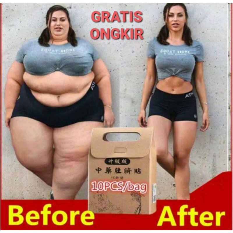 100% ORI Patch Detox Slim KOYO Pelangsing Tubuh