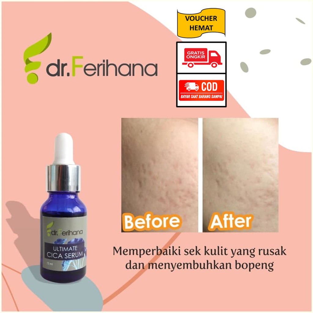 CICA SERUM/SERUM WAJAH BOPENG/BEKAS LUKA/JERAWAT/AMAN BUMIL/BPOM/SKINCARE HALAL/DR.FERIHANA/FERIHANA