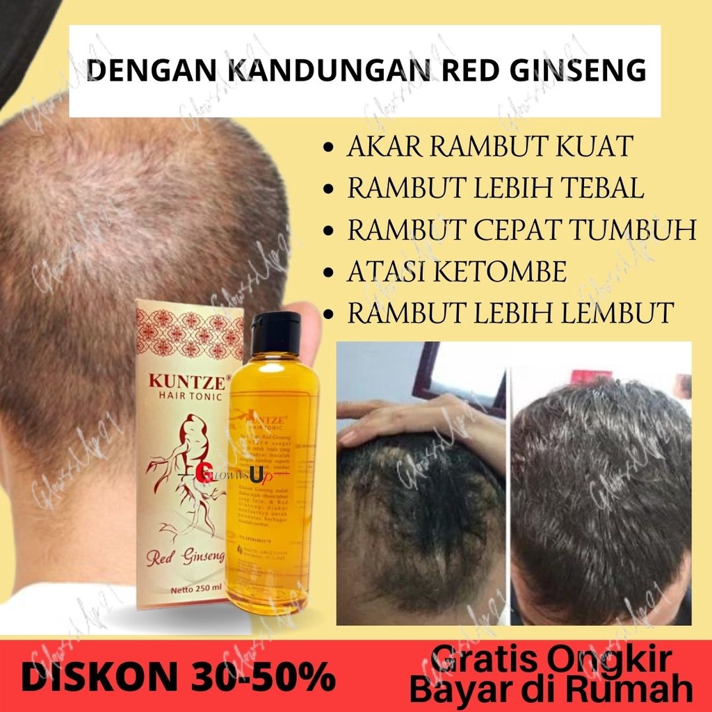 KUNTZE HAIR TONIC RED GINSENG 250ML BPOM - TONIC KUNTZE RED GINSENG